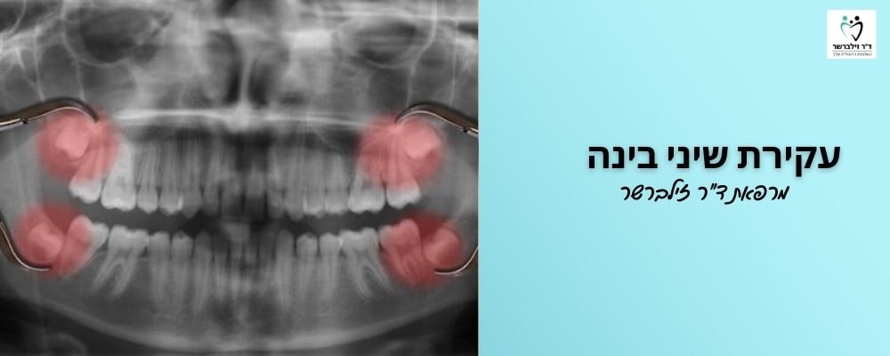 עקירת שיני בינה | מרפאת ד"ר זילברשר